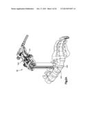 DETACHABLE DILATOR BLADE diagram and image