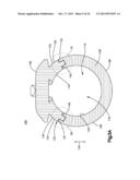 DETACHABLE DILATOR BLADE diagram and image