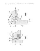 DETACHABLE DILATOR BLADE diagram and image