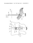 DETACHABLE DILATOR BLADE diagram and image