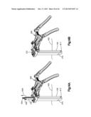 DETACHABLE DILATOR BLADE diagram and image