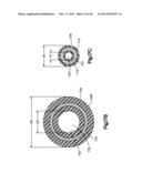 DETACHABLE DILATOR BLADE diagram and image