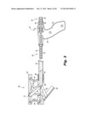 SURGICAL DEVICE FOR INTERNALLY MANIPULATING AN ORGAN diagram and image