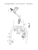 SURGICAL DEVICE FOR INTERNALLY MANIPULATING AN ORGAN diagram and image