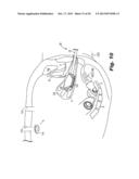 SURGICAL DEVICE FOR INTERNALLY MANIPULATING AN ORGAN diagram and image