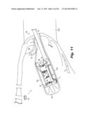 SURGICAL DEVICE FOR INTERNALLY MANIPULATING AN ORGAN diagram and image