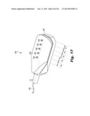 SURGICAL DEVICE FOR INTERNALLY MANIPULATING AN ORGAN diagram and image