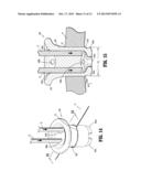 Foam Introduction System Including Modified Port Geometry diagram and image