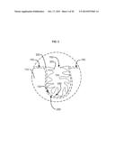 APPURTENANCES TO CAVITY WOUND DRESSINGS diagram and image