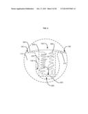 APPURTENANCES TO CAVITY WOUND DRESSINGS diagram and image