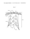 APPURTENANCES TO CAVITY WOUND DRESSINGS diagram and image