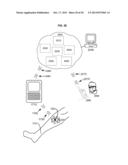 APPURTENANCES TO CAVITY WOUND DRESSINGS diagram and image