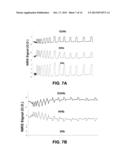 Systems And Methods For Measuring Mitochondrial Capacity diagram and image