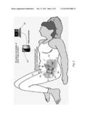 ELECTRONIC PELVIC ORGAN PROLAPSE QUANTIFICATION SYSTEM diagram and image