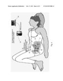 ELECTRONIC PELVIC ORGAN PROLAPSE QUANTIFICATION SYSTEM diagram and image