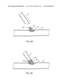 DELIVERY SYSTEM FOR IMPLANTABLE FLOW CONNECTOR diagram and image