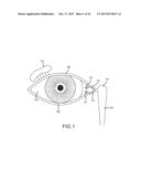 IMPLANT DEVICE, TOOL, AND METHODS RELATING TO TREATMENT OF PARANASAL     SINUSES diagram and image