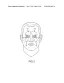 IMPLANT DEVICE, TOOL, AND METHODS RELATING TO TREATMENT OF PARANASAL     SINUSES diagram and image