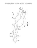 SYSTEM AND METHOD FOR IMPROVING OUTCOME OF CEREBRAL ISCHEMIA diagram and image