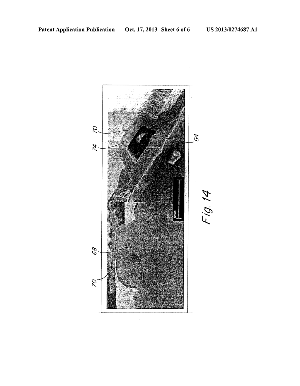 DEVICE FOR IN VIVO DELIVERY OF BIOACTIVE AGENTS AND METHOD OF MANUFACTURE     THEREOF - diagram, schematic, and image 07