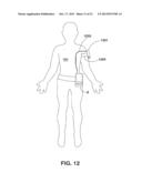 FEEDBACK-BASED DIURETIC OR NATRIURETIC MOLECULE ADMINISTRATION diagram and image