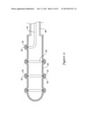 RENAL NERVE MODULATION CATHETER DESIGN diagram and image