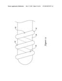 RENAL NERVE MODULATION CATHETER DESIGN diagram and image