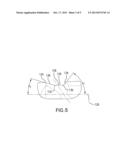 BUMP CUT ON HOLE EDGE diagram and image