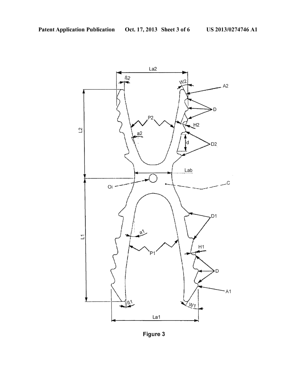 OSTEOSYNTHESIS DEVICE - diagram, schematic, and image 04