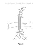 SURGICAL TISSUE COLLECTION BAG diagram and image