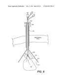 SURGICAL TISSUE COLLECTION BAG diagram and image