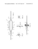 APPARATUS FOR OCCLUDING BODY LUMENS diagram and image