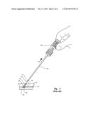 TISSUE PUNCTURE CLOSURE DEVICE WITH AUTOMATIC TORQUE SENSING TAMPING     SYSTEM diagram and image