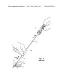 TISSUE PUNCTURE CLOSURE DEVICE WITH AUTOMATIC TORQUE SENSING TAMPING     SYSTEM diagram and image