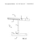 ANCHOR DELIVERY SYSTEM diagram and image