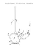 ANCHOR DELIVERY SYSTEM diagram and image