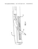 ANCHOR DELIVERY SYSTEM diagram and image