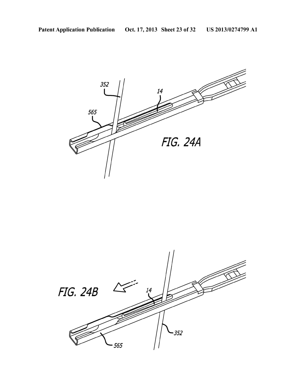 ANCHOR DELIVERY SYSTEM - diagram, schematic, and image 24