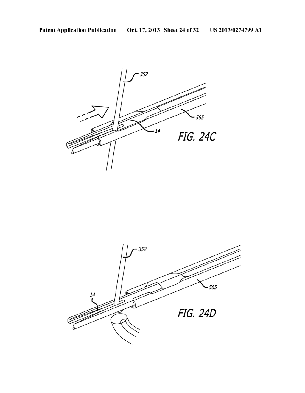 ANCHOR DELIVERY SYSTEM - diagram, schematic, and image 25