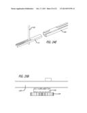 ANCHOR DELIVERY SYSTEM diagram and image