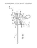 ANCHOR DELIVERY SYSTEM diagram and image