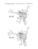 ANCHOR DELIVERY SYSTEM diagram and image