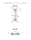 SPINAL FIXATION PLATES diagram and image