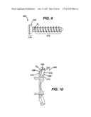 SPINAL FIXATION PLATES diagram and image