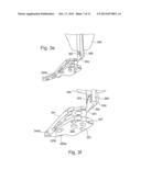 TARGETING DEVICE FOR ORTHOPEDIC IMPLANTS diagram and image