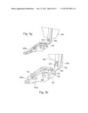 TARGETING DEVICE FOR ORTHOPEDIC IMPLANTS diagram and image