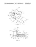 MINIMALLY INVASIVE IMPLANT AND CRIMPING SYSTEM diagram and image