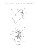 MINIMALLY INVASIVE IMPLANT AND CRIMPING SYSTEM diagram and image