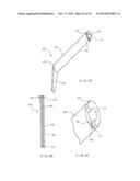 MINIMALLY INVASIVE IMPLANT AND CRIMPING SYSTEM diagram and image