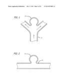 METHODS AND DEVICES FOR TREATMENT OF VASCULAR DEFECTS diagram and image